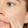 Dermalogica Deep Breakout Liquid Patch Usage
